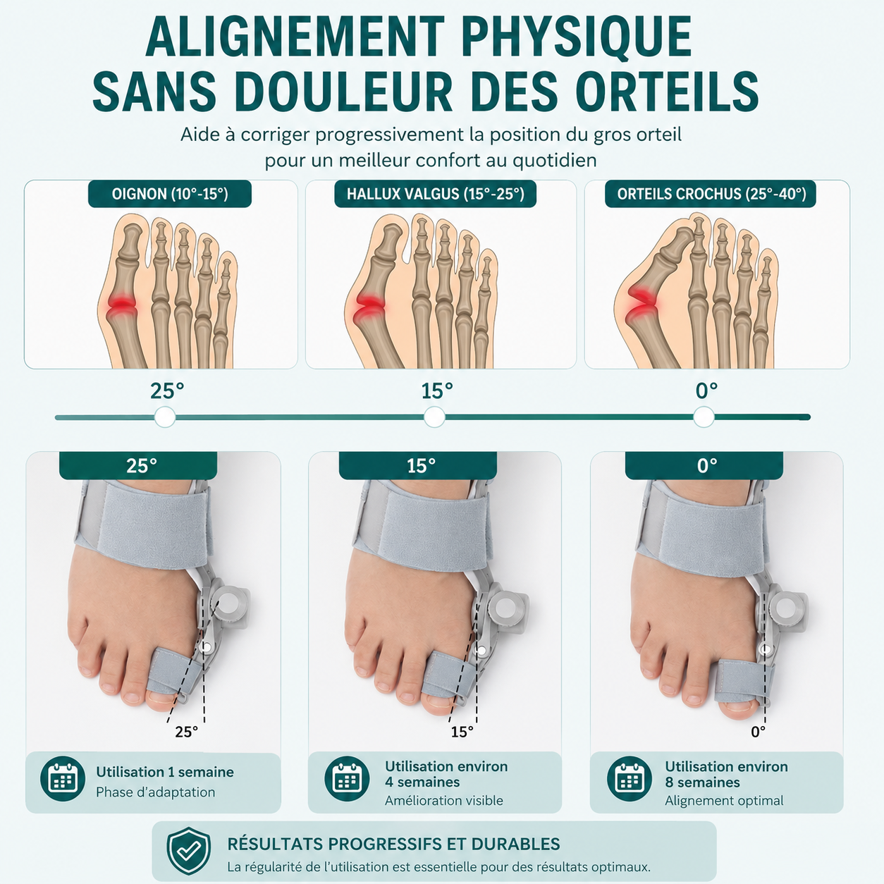 Correcteur Hallux Valgus — Soulagement de l'Oignon