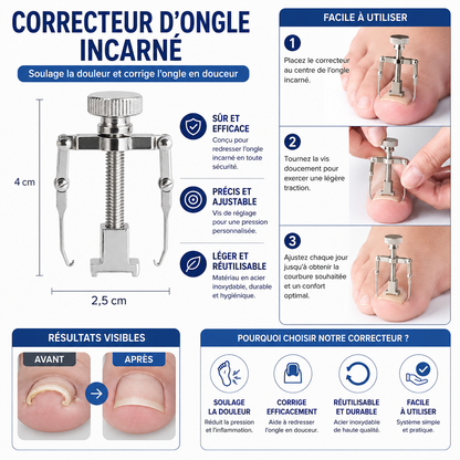 Correcteur Ongle Incarné — Redresseur et Clip de Soin
