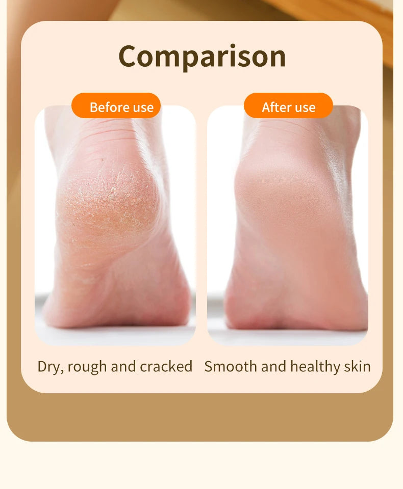 Ponceuse Électrique Rechargeable pour Pieds — Peau Douce Sans Effort ni Douleur
