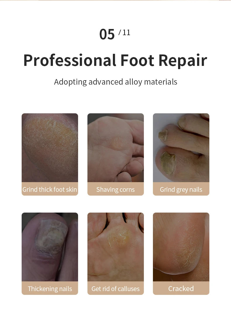 Ponceuse Électrique Rechargeable pour Pieds — Peau Douce Sans Effort ni Douleur