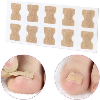 Correcteur Ongle Incarné — Redresseur et Clip de Soin